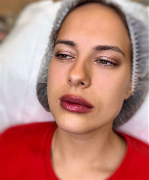 Clear lips contour by cidk | Lip contouring, Botox lips, Lip enhancement