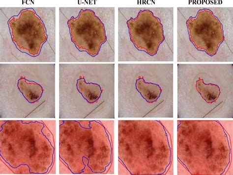 The performance comparison of proposed method with U-NET, FCN and HRCN ...