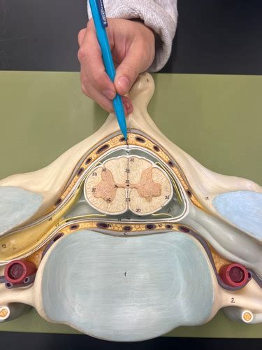 Spinous process model (100%) Flashcards | Quizlet