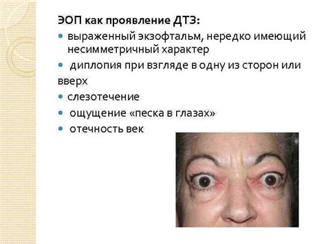 Диффузный токсический зоб Клиника Диагностика Методы лечения Заместительная