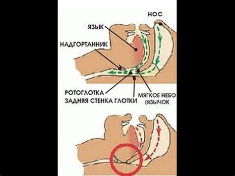 Средство от храпа асонор цена - быстро и просто! - YouTube