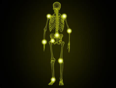 Free photo: Painful Joints - Illustration - Pain, Rheumatism, Posture