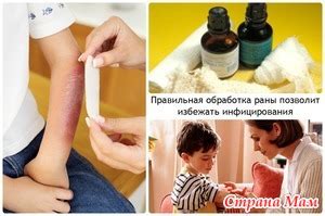 Обработка ран и царапин у детей: как и чем? - Страна Мам