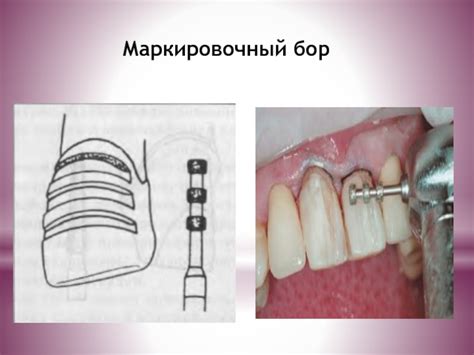 Препарирование презентация, доклад